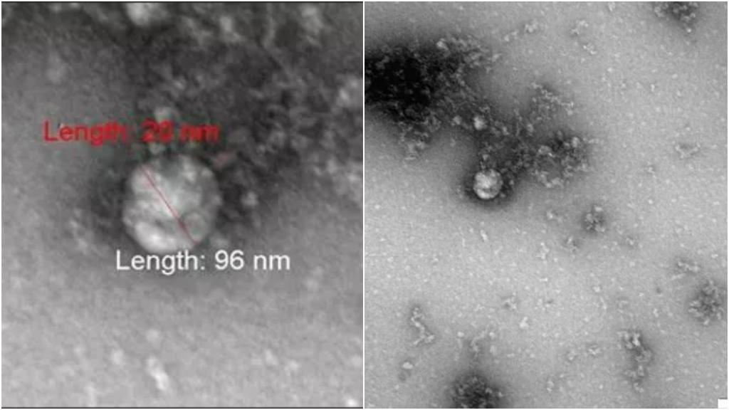 أول صورة في العالم للسلالة &quot;البريطانية&quot; من فيروس كورونا!